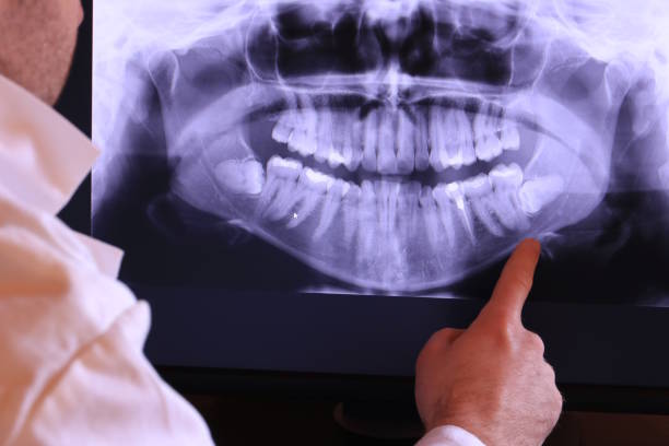 Best Emergency Denture Repair in Lovejoy, GA