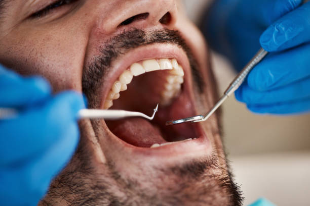 Best Emergency Treatment for Jaw Pain or Injury in Lovejoy, GA