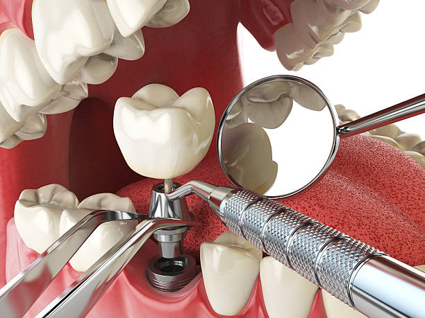 Best Emergency Dental Care for Sports Injuries in Lovejoy, GA